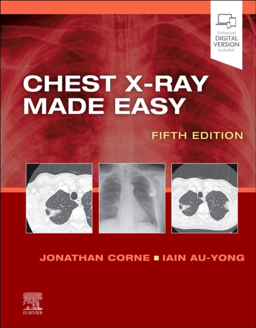 Book cover of: Chest X-Ray Made Easy. By: Jonathan Corne