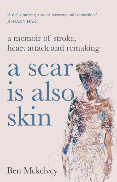 Book cover of: Scar is Also Skin. By: Ben Mckelvey