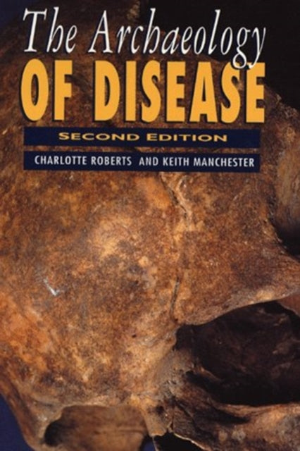 Book cover of: Archaeology of Disease. By: Charlotte A. Roberts