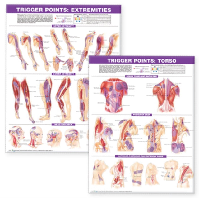 Book cover of: Trigger Point Chart Set: Torso & Extremities Paper