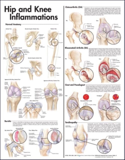 Book cover of: Hip and Knee Inflammations Anatomical Chart