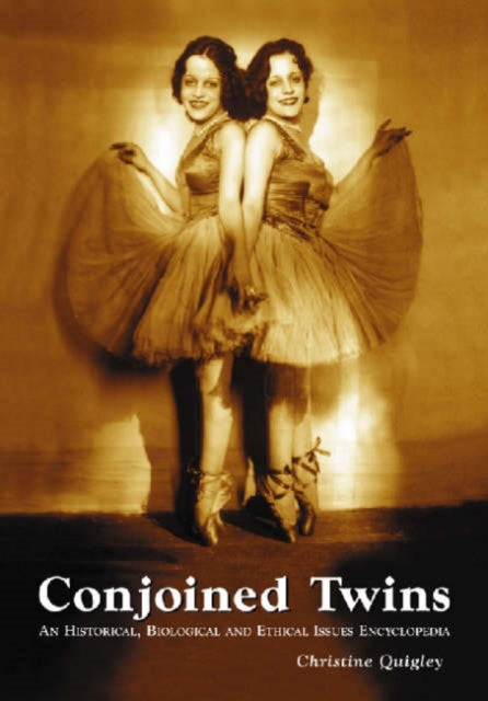 Book cover of: Conjoined Twins. By: Christine Quigley