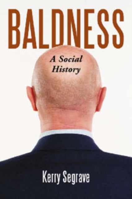 Book cover of: Baldness. By: Kerry Segrave