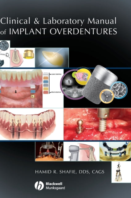 Book cover of: Clinical and Laboratory Manual of Implant Overdentures. By: Hamid Shafie, Hamid R. Shafie