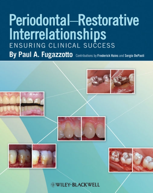 Book cover of: Periodontal-Restorative Interrelationships. By: Paul A. Fugazzotto