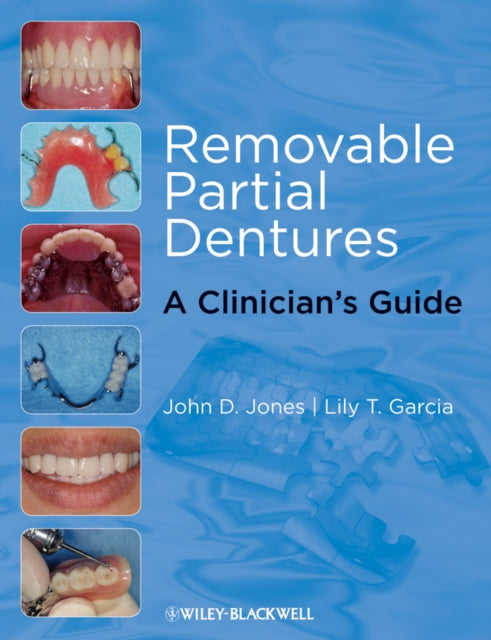 Book cover of: Removable Partial Dentures. By: Jones, John D. Dr.