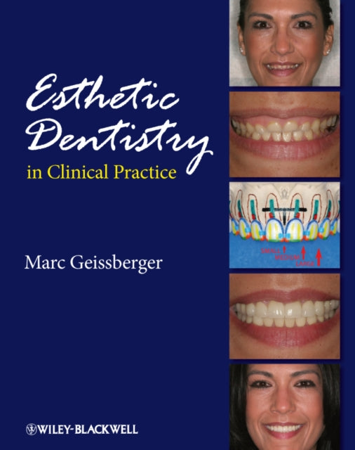 Book cover of: Esthetic Dentistry in Clinical Practice. By: Marc Geissberger