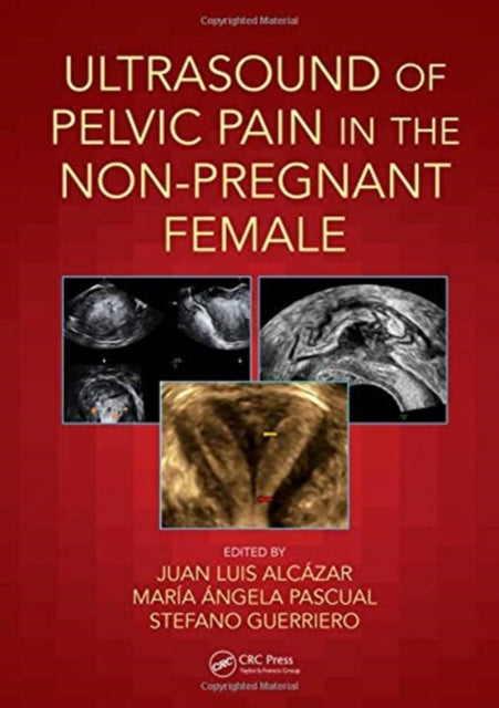 Book cover of: Ultrasound of Pelvic Pain in the Non-Pregnant Patient. By: Juan Luis Alcázar