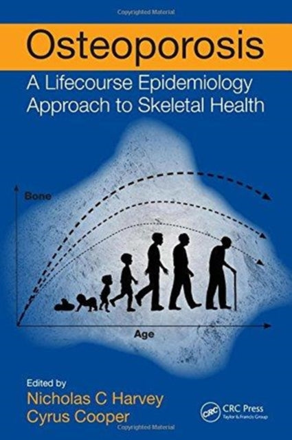 Book cover of: Osteoporosis