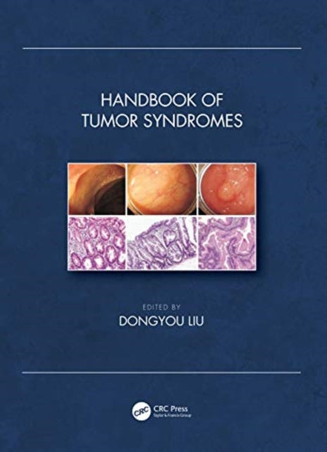 Book cover of: Handbook of Tumor Syndromes. By: Dongyou Liu