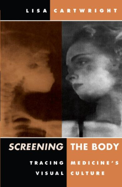 Book cover of: Screening the Body