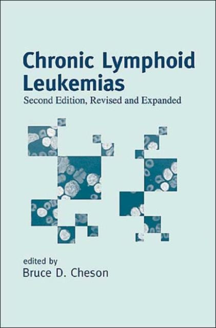 Book cover of: Chronic Lymphoid Leukemias. By: Cheson