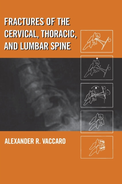 Book cover of: Fractures of the Cervical, Thoracic, and Lumbar Spine. By: Vaccaro
