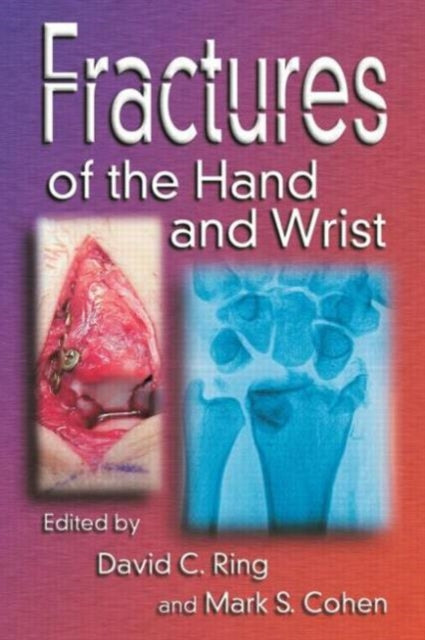 Book cover of: Fractures of the Hand and Wrist