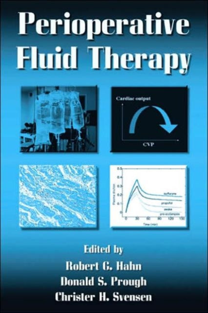 Book cover of: Perioperative Fluid Therapy