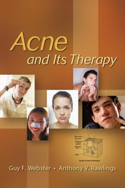 Book cover of: Acne and Its Therapy