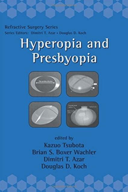 Book cover of: Hyperopia and Presbyopia
