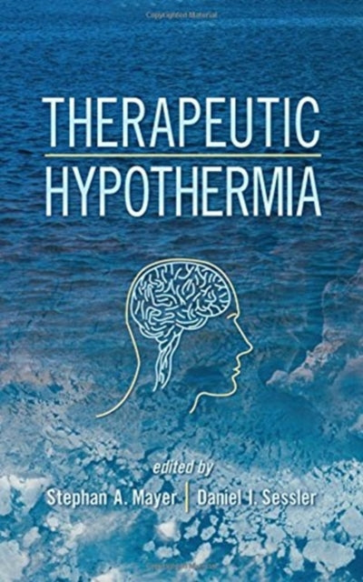 Book cover of: Therapeutic Hypothermia