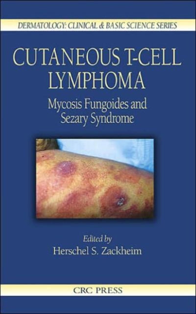 Book cover of: Cutaneous T-Cell Lymphoma. By: Herschel S. Zackheim