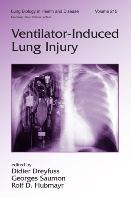 Book cover of: Ventilator-Induced Lung Injury