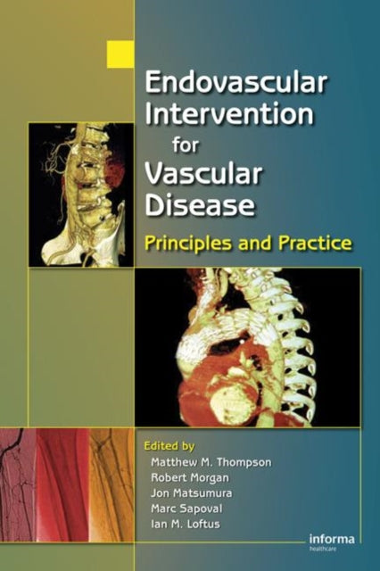 Book cover of: Endovascular Intervention for Vascular Disease