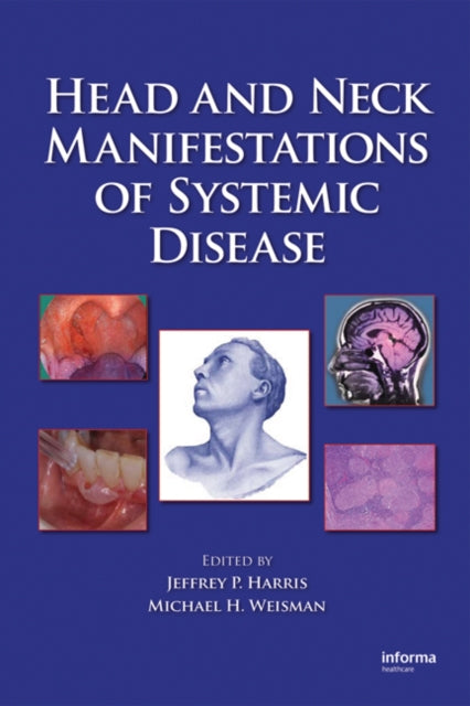 Book cover of: Head and Neck Manifestations of Systemic Disease