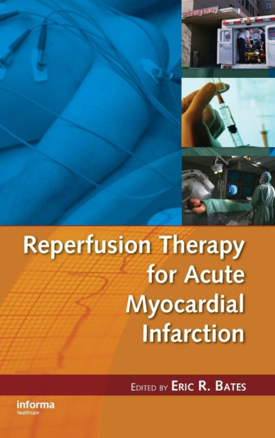 Book cover of: Reperfusion Therapy for Acute Myocardial Infarction. By: Eric R. Bates