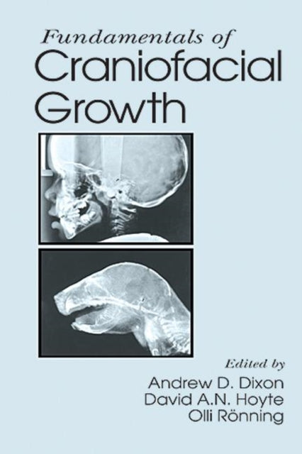 Book cover of: Fundamentals of Craniofacial Growth
