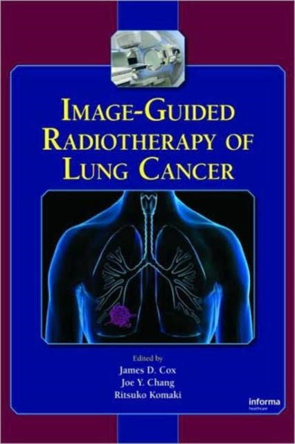 Book cover of: Image-Guided Radiotherapy of Lung Cancer