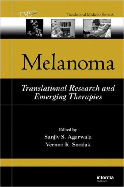 Book cover of: Melanoma