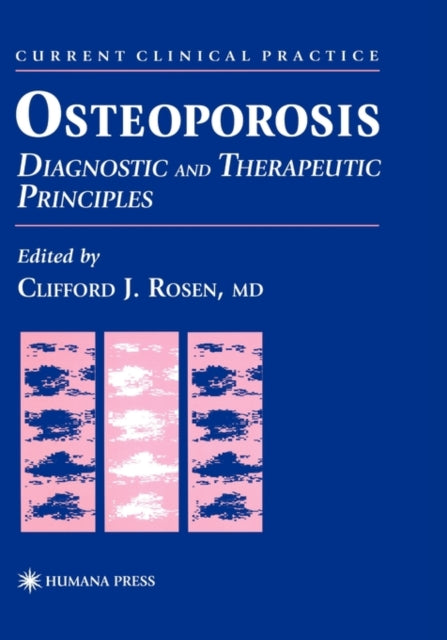 Book cover of: Osteoporosis. By: Clifford J. Rosen