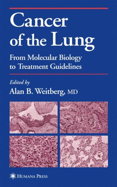 Book cover of: Cancer of the Lung. By: Alan B. Weitberg