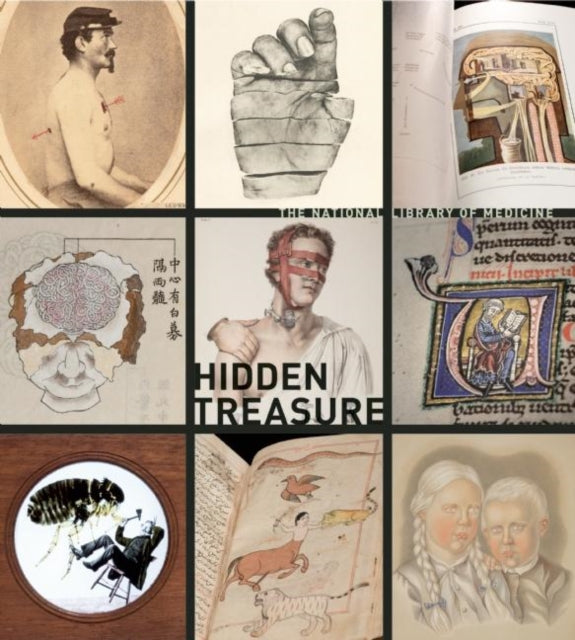 Book cover of: Hidden Treasure. By: Michael Sappol