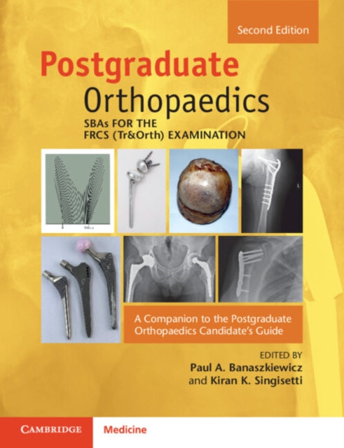 Book cover of: SBAs for the FRCS (Tr&Orth) Examination. By: Paul A. Banaszkiewicz