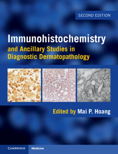 Book cover of: Immunohistochemistry and Ancillary Studies in Diagnostic Dermatopathology
