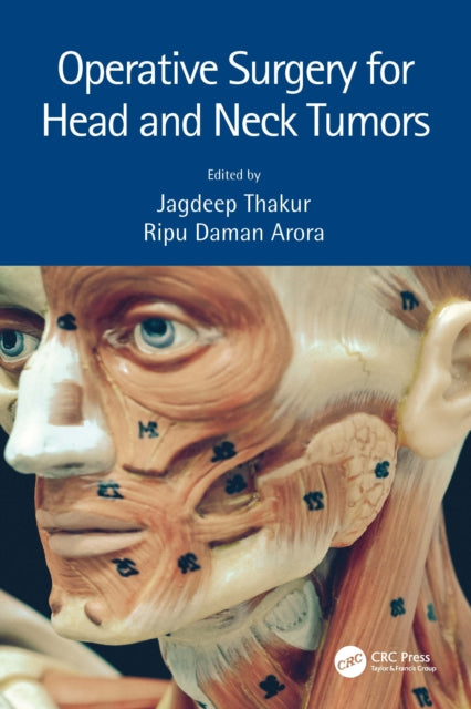 Book cover of: Operative Surgery for Head and Neck Tumors. By: Jagdeep Thakur