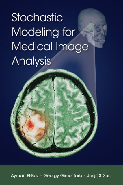 Book cover of: Stochastic Modeling for Medical Image Analysis. By: Ayman S. El-Baz