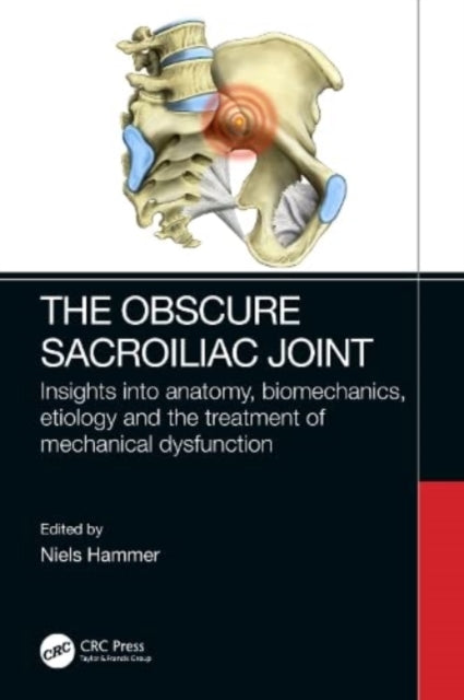 Book cover of: Obscure Sacroiliac Joint. By: Niels Hammer