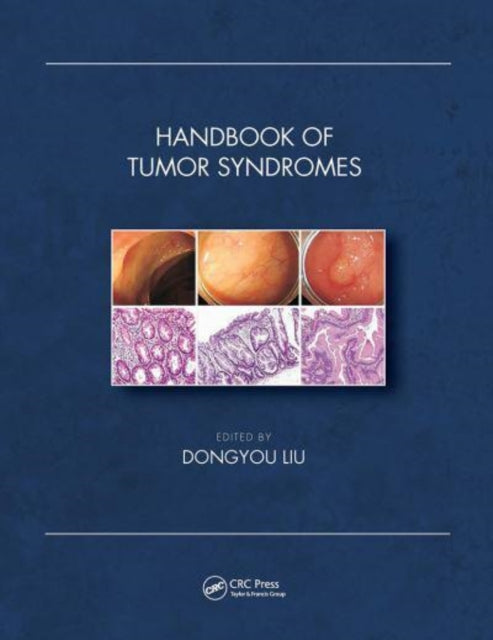Book cover of: Handbook of Tumor Syndromes. By: Dongyou Liu