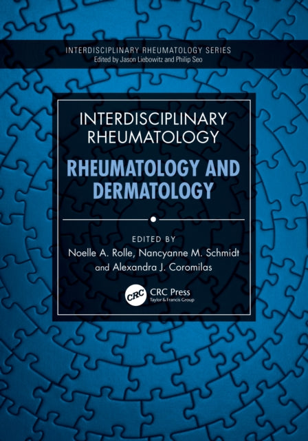 Book cover of: Interdisciplinary Rheumatology: Rheumatology and Dermatology