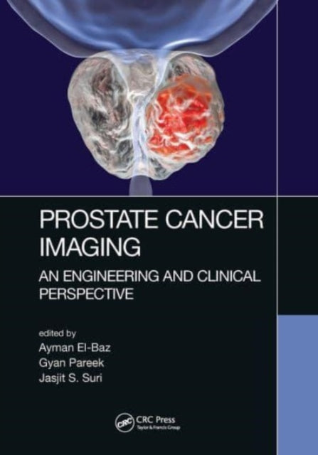 Book cover of: Prostate Cancer Imaging. By: Ayman S. El-Baz