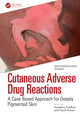 Book cover of: Cutaneous Adverse Drug Reactions