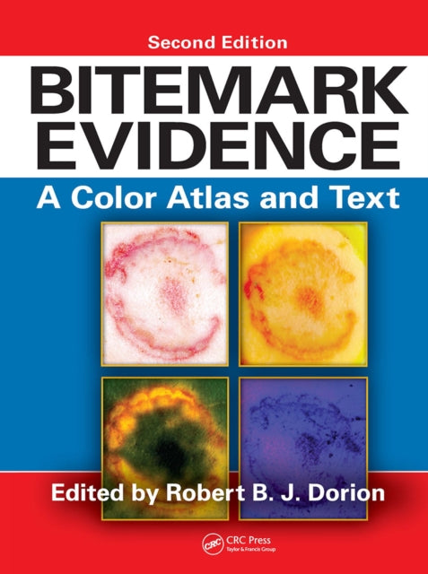 Book cover of: Bitemark Evidence