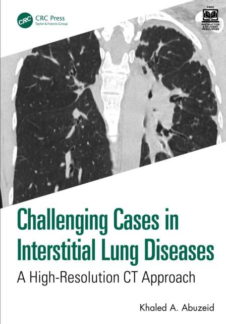 Book cover of: Challenging Cases in Interstitial Lung Diseases. By: Khaled A. Abuzeid