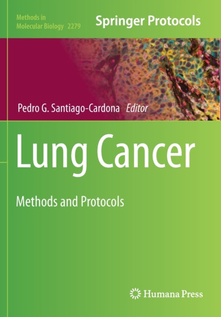 Book cover of: Lung Cancer
