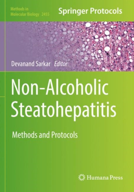 Book cover of: Non-Alcoholic Steatohepatitis. By: Devanand Sarkar