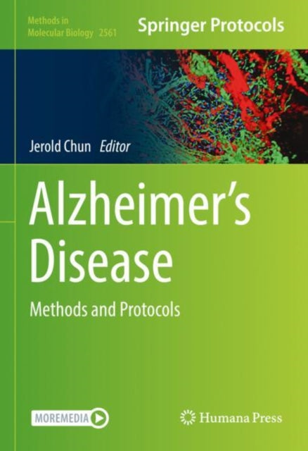 Book cover of: Alzheimer’s Disease. By: Jerold Chun