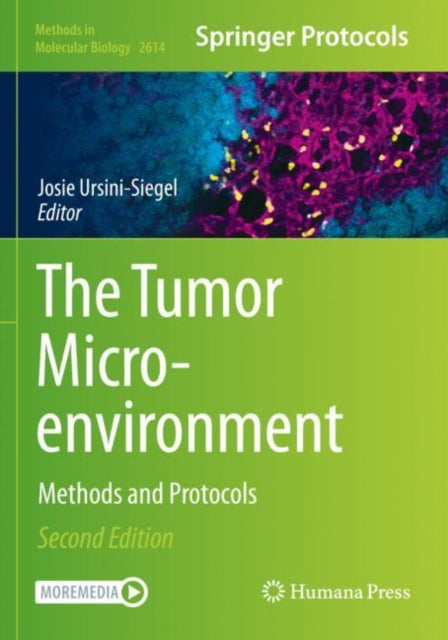 Book cover of: Tumor Microenvironment. By: Josie Ursini-Siegel