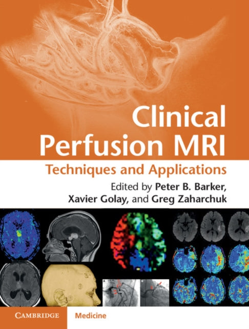 Book cover of: Clinical Perfusion MRI. By: Peter Barker