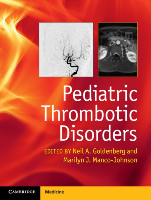 Book cover of: Pediatric Thrombotic Disorders. By: Neil A. Goldenberg